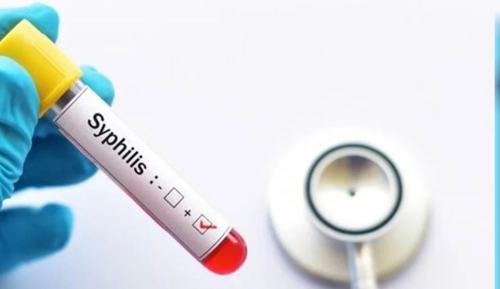 Crisis sanitaria: Especialistas alertan sobre un aumento descontrolado de casos de&nbsp;sífilis