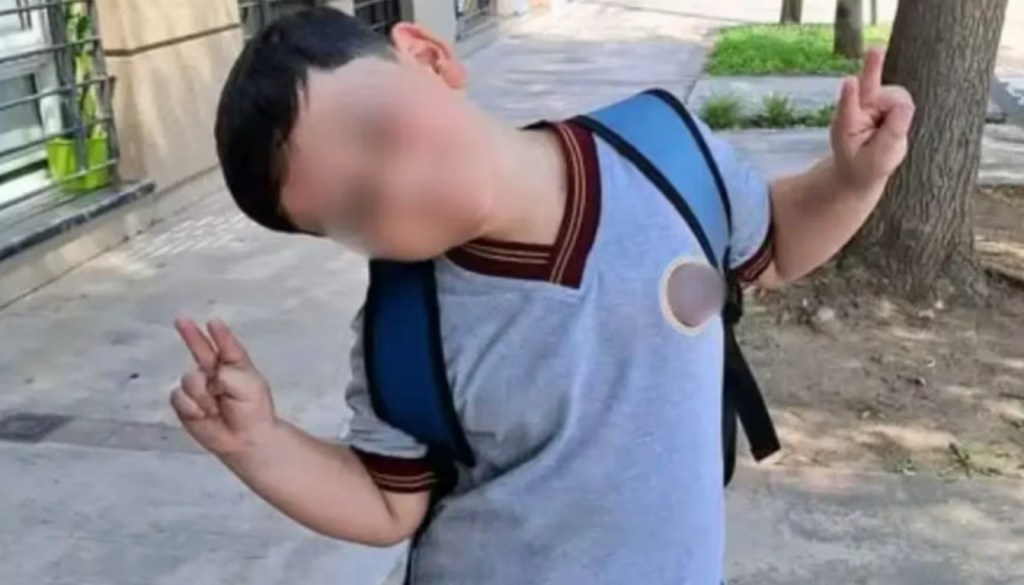 Bastián Jerez debió ser intervenido nuevamente en su complejo proceso de&nbsp;recuperación